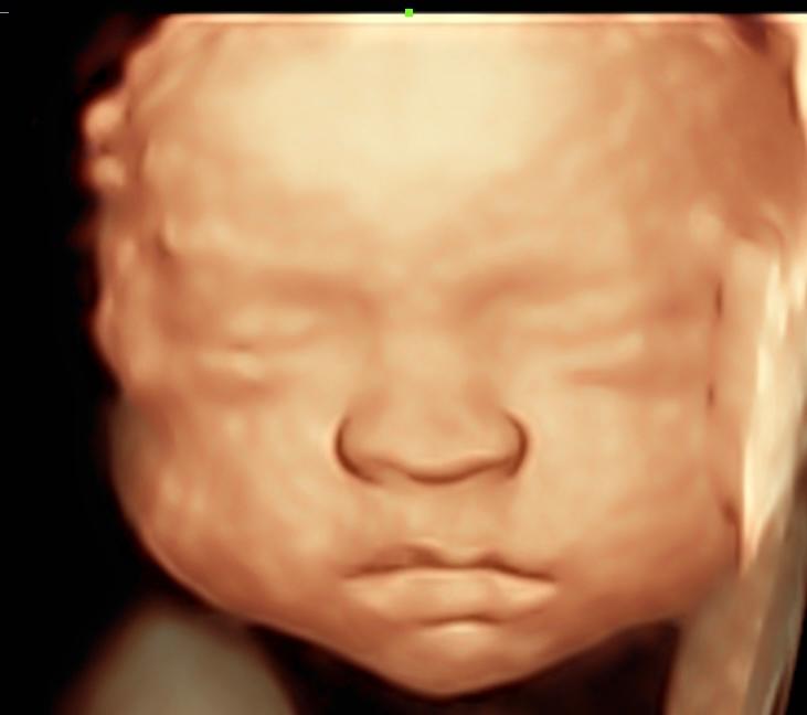 unnamed image
