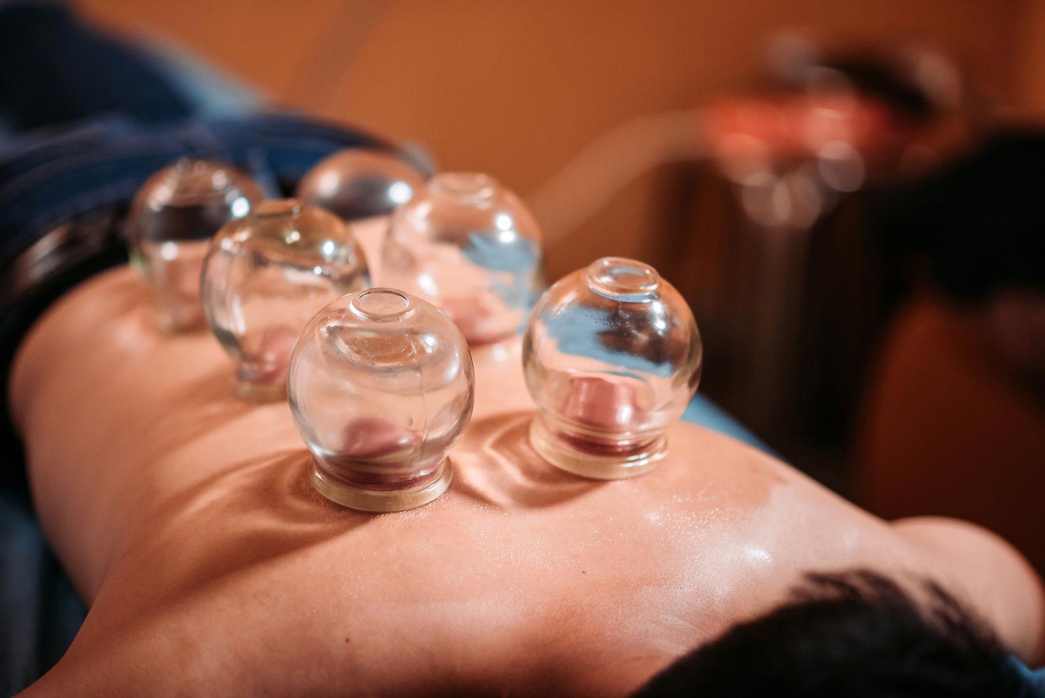 Suction cups on patient