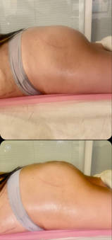 CurveโงInfusionโขโจ treatment photograph
